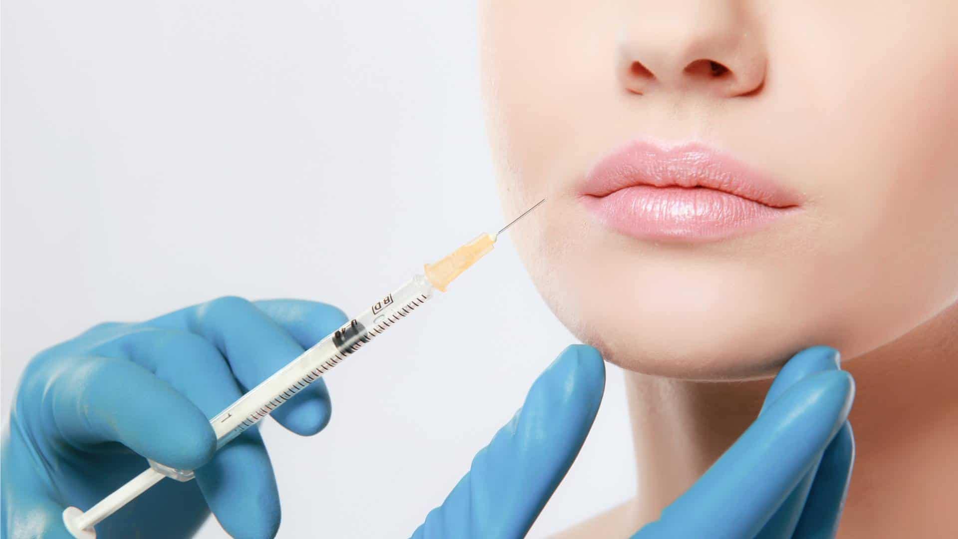 Hyaluronsäure Spritze_Lippe